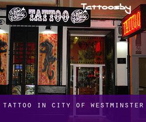 Tattoo in City of Westminster