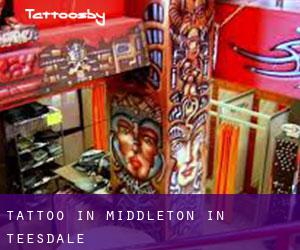 Tattoo in Middleton in Teesdale
