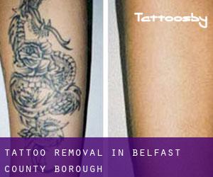 Tattoo Removal in Belfast County Borough