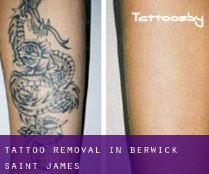 Tattoo Removal in Berwick Saint James