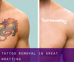 Tattoo Removal in Great Wratting