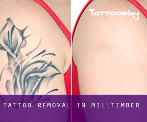 Tattoo Removal in Milltimber