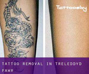 Tattoo Removal in Treleddyd-fawr