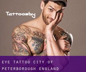 Eye tattoo (City of Peterborough, England)